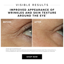 Alavida Patches Cellular Skin Repair + Anti-Aging + Reduce Fine Lines & Wrinkles